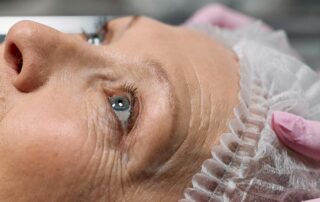 Patient bekommt bei Grauer Star Operation torische Linsen zur Korrektur der Hornhautverkrümmung eingesetzt